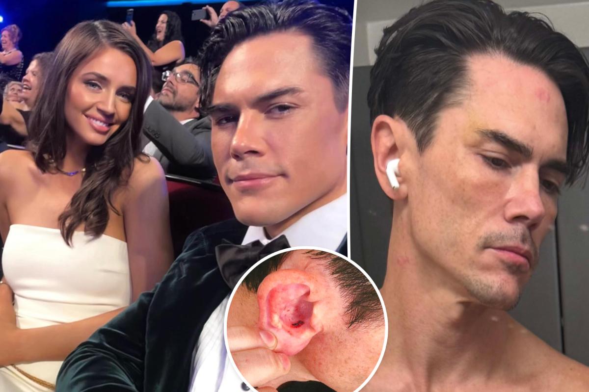 Tom Sandoval's Shocking Night: Alleged Attack Leaves Him Bloody and Bruised